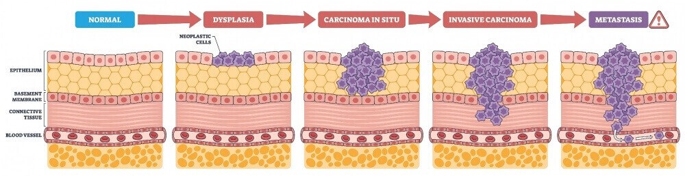 In Vivo Phage Library Screening Service for Tumor Targeting