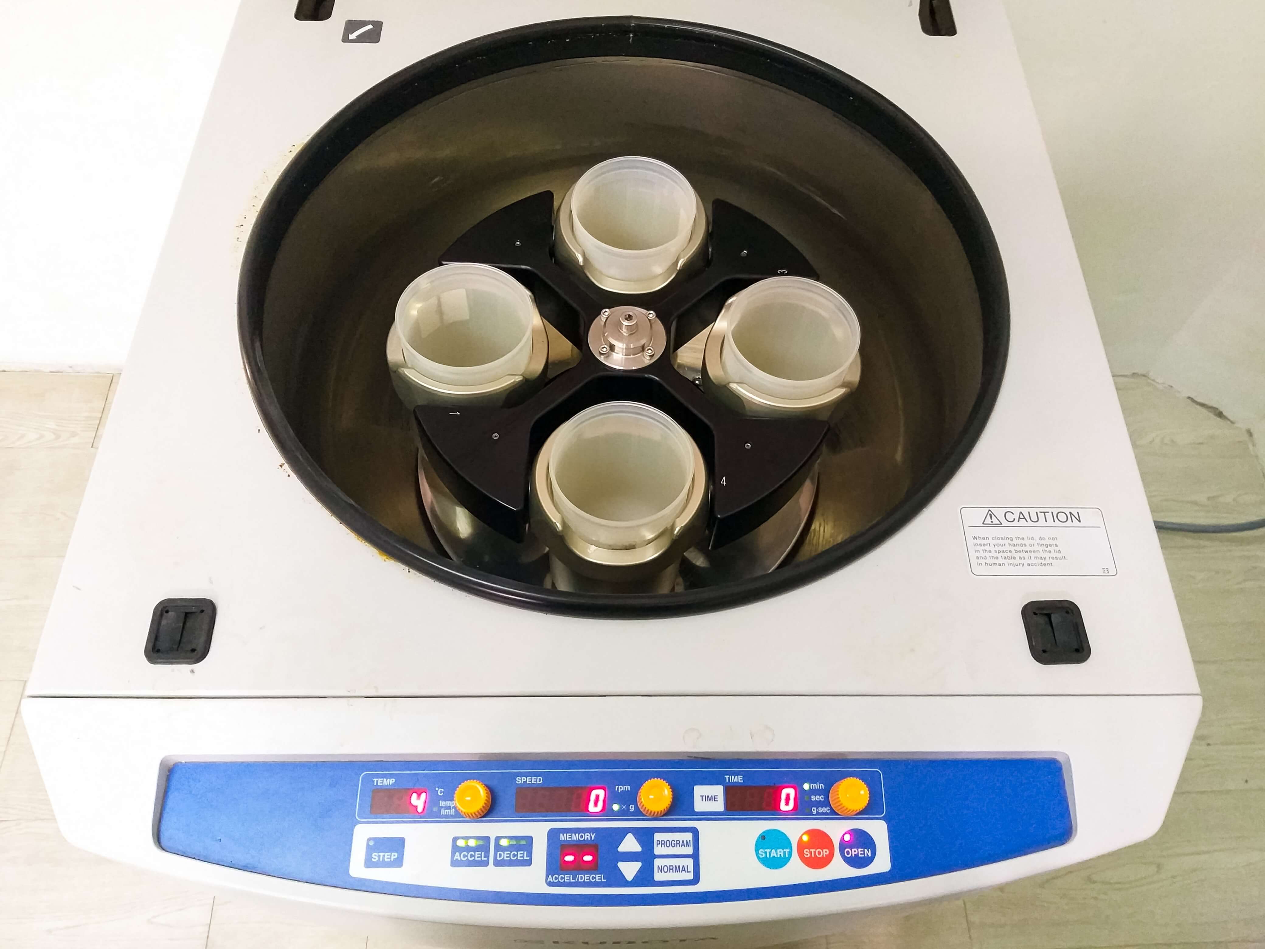 Ultracentrifugation