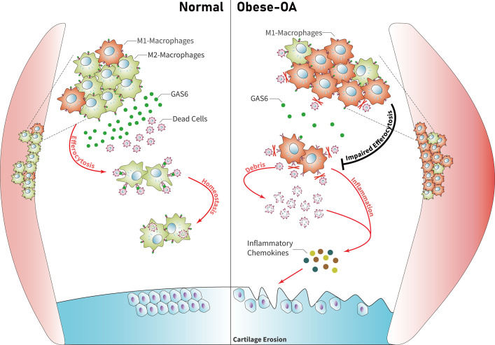 Fig. 1 Comparative schematic of GAS6-mediated joint homeostasis in normal and obese osteoarthritic cartilage. (OA Literature)