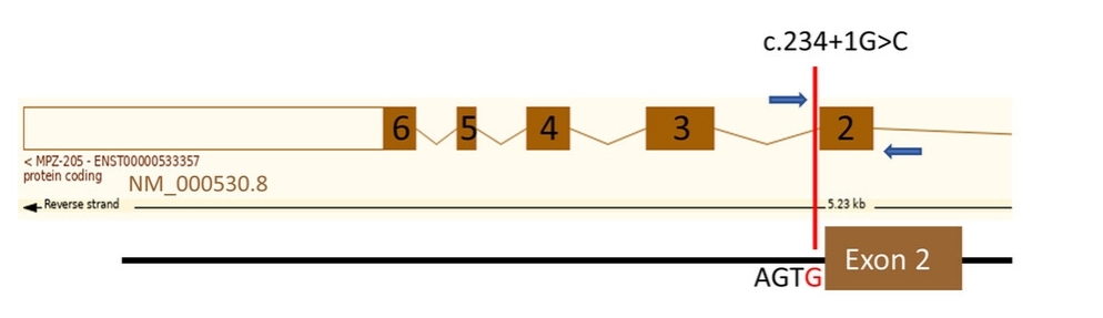 Fig.1 Schematic of the MPZ minigene. (OA Literature)