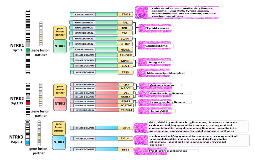 Fig.1 NTRK1 in different cancers. (OA Literature)