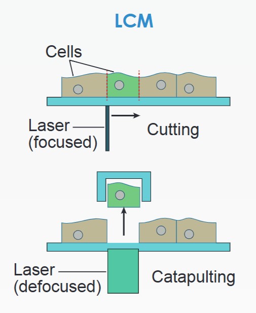 The workflow for LCM technology. (Creative Biolabs Original).