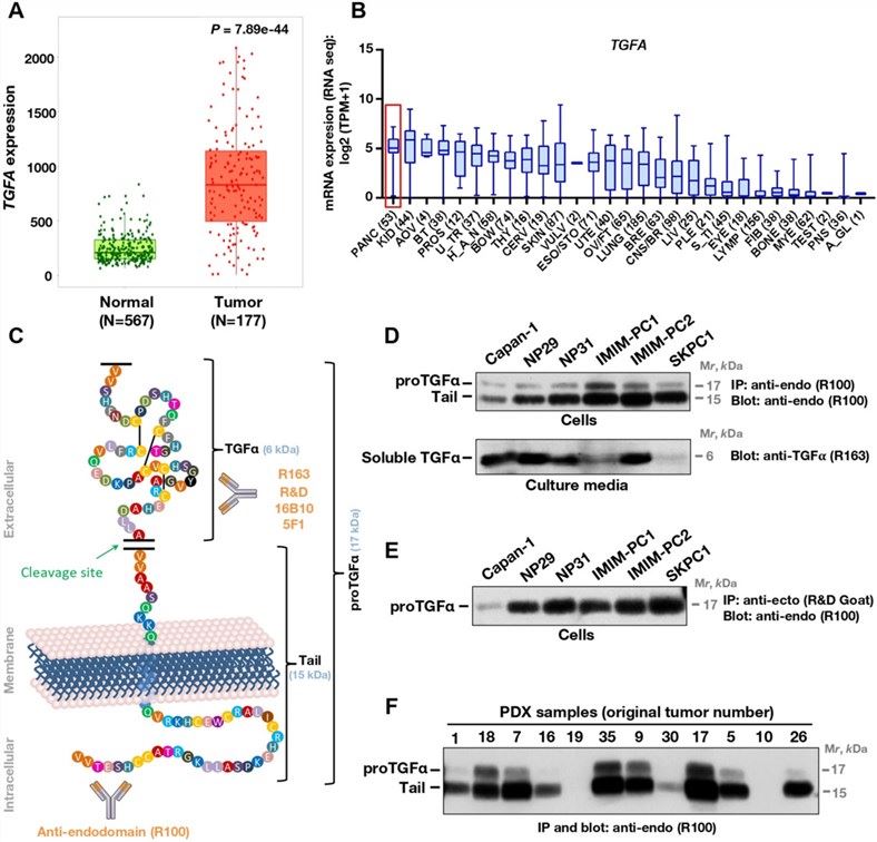 Fig.1 TGFΑ expression in cancer. (OA Literature)
