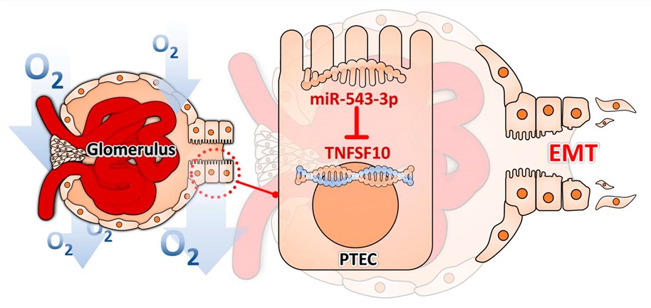 Fig.1 Hypoxia induced EMT in PTECs through miR-545-3p–TNFSF10. (OA Literature)