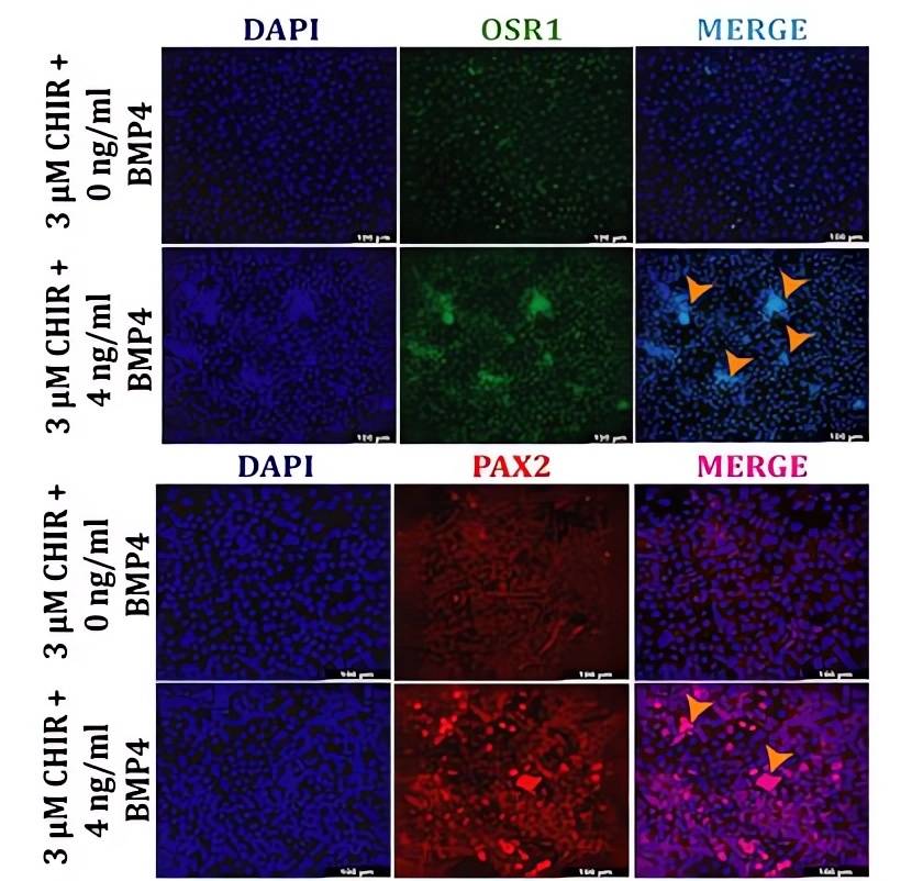 Promote the differentiation of iPSCs towards IM by using BMP of different concentrations. (OA Literature)