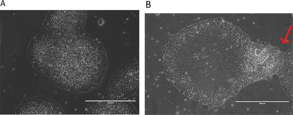 Morphology of iPSC colonies observed via microscopy. (OA Literature)