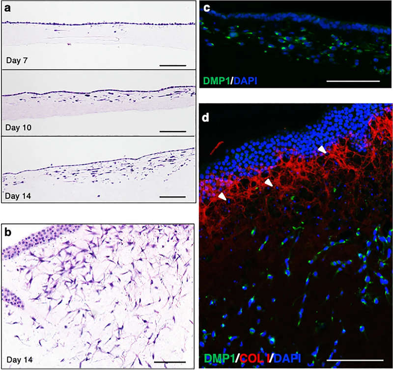Induction of osteoblastic and osteocytic cells on type I collagen gel. (OA Literature)