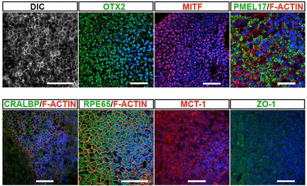 Fig.1 Microscopy of MITF in hESC-RPE cells. (Limnios, et al., 2021)