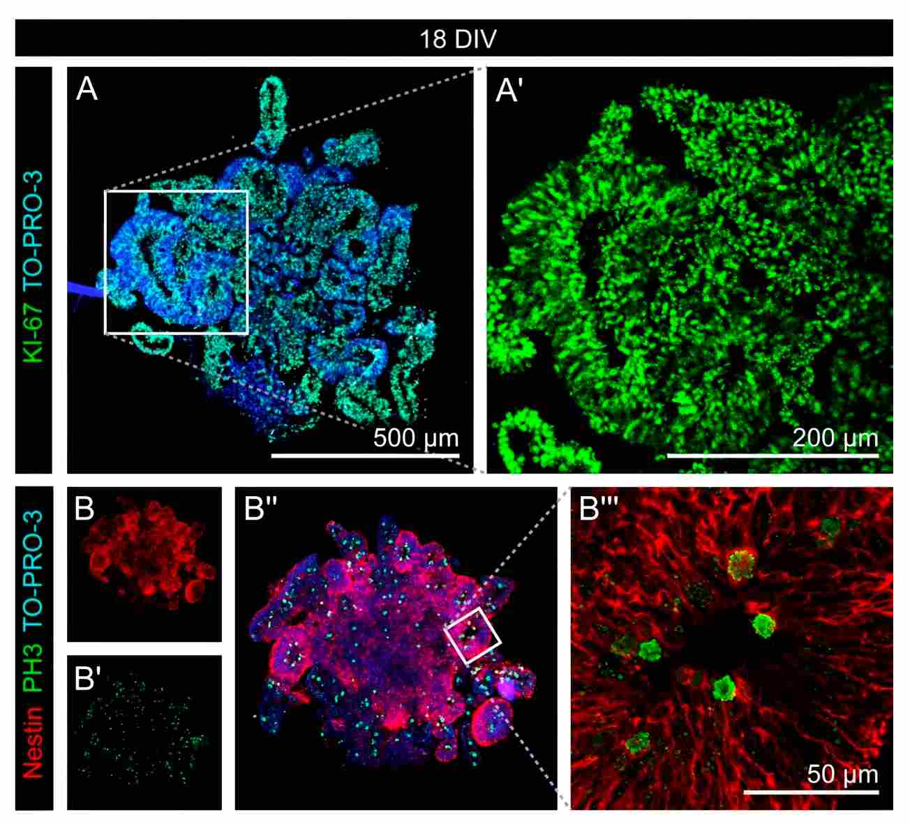 Confocal microscopy image of proliferating neural progenitor cells in a cerebral organoid.