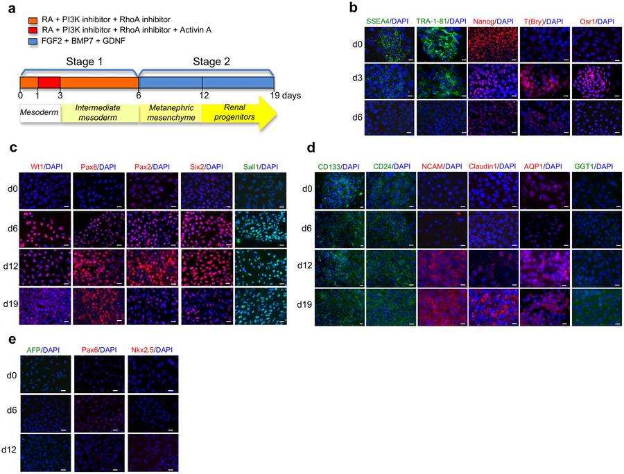 Renal progenitors derived from human iPSCs.(OA Literature)