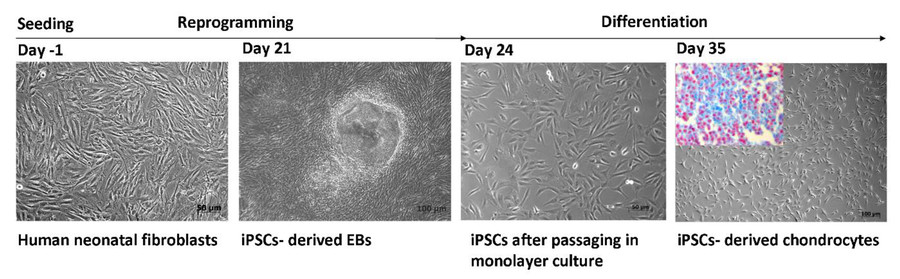 The generation of iPSC-derived chondrocytes.(OA Literature)