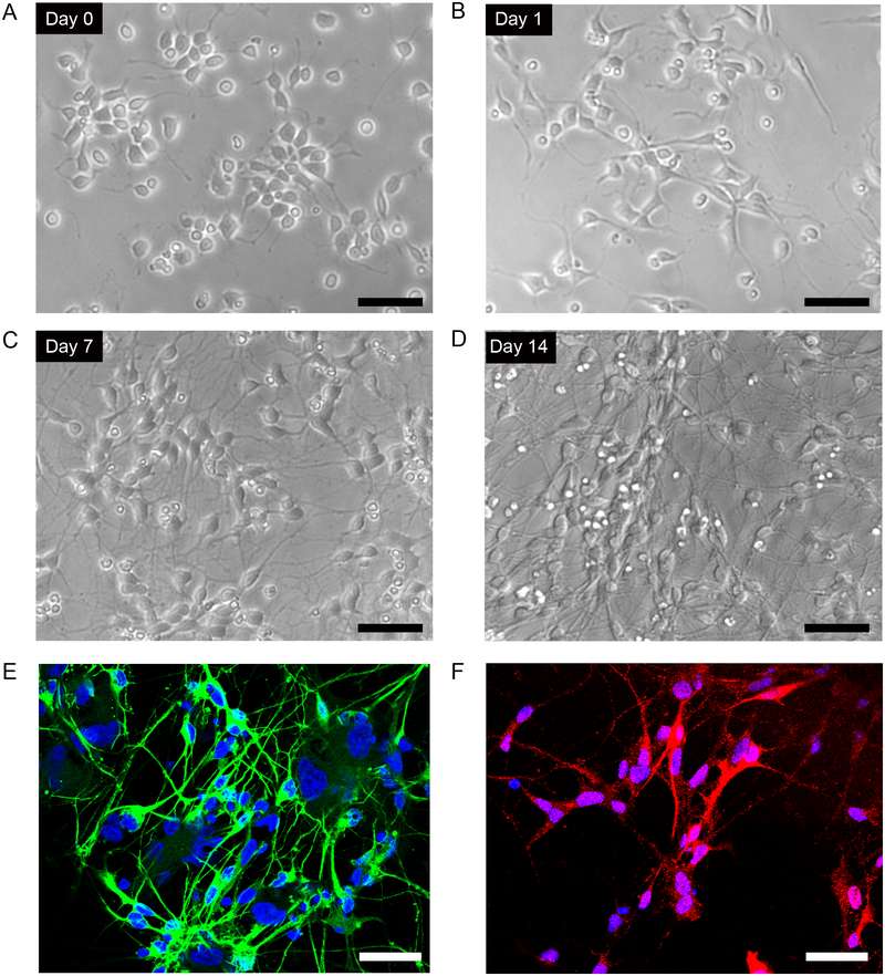 Differentiation of human iPSC-derived neural progenitor cells into dopaminergic neurons. (OA Literature)