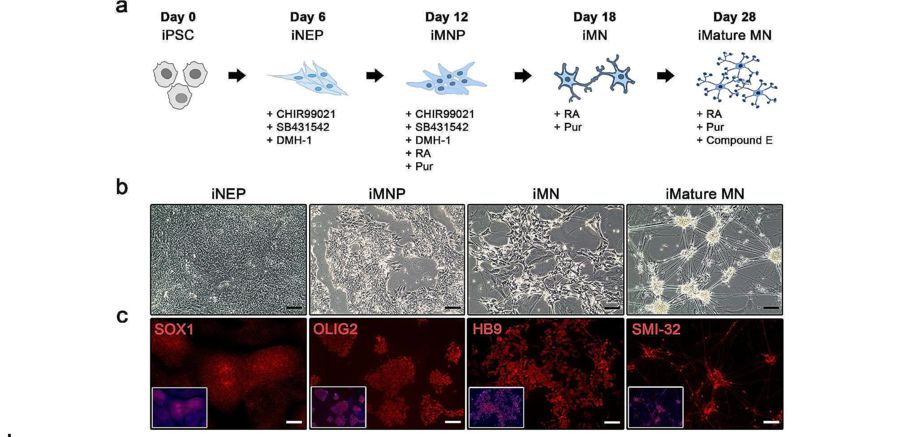 Human iPSC derived motor neuron progenitor and motor neuron differentiation. (OA Literature)
