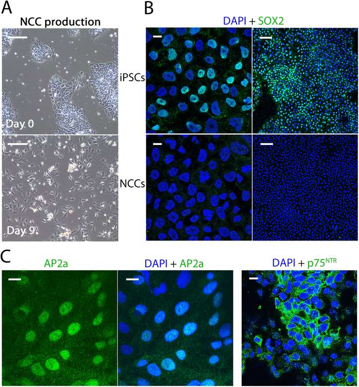 Characterization of Human Sensory Neurons Generated from Non-Modified iPSCs. (OA Literature)