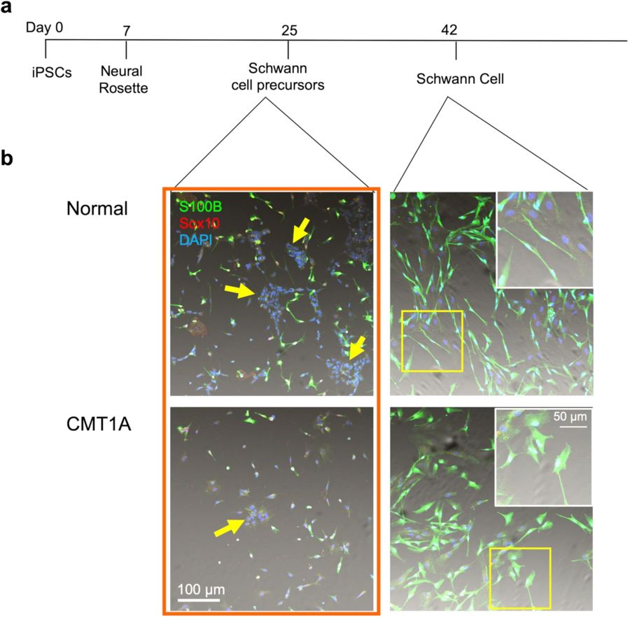 Schwann cell differentiation from iPS cells. (OA Literature)