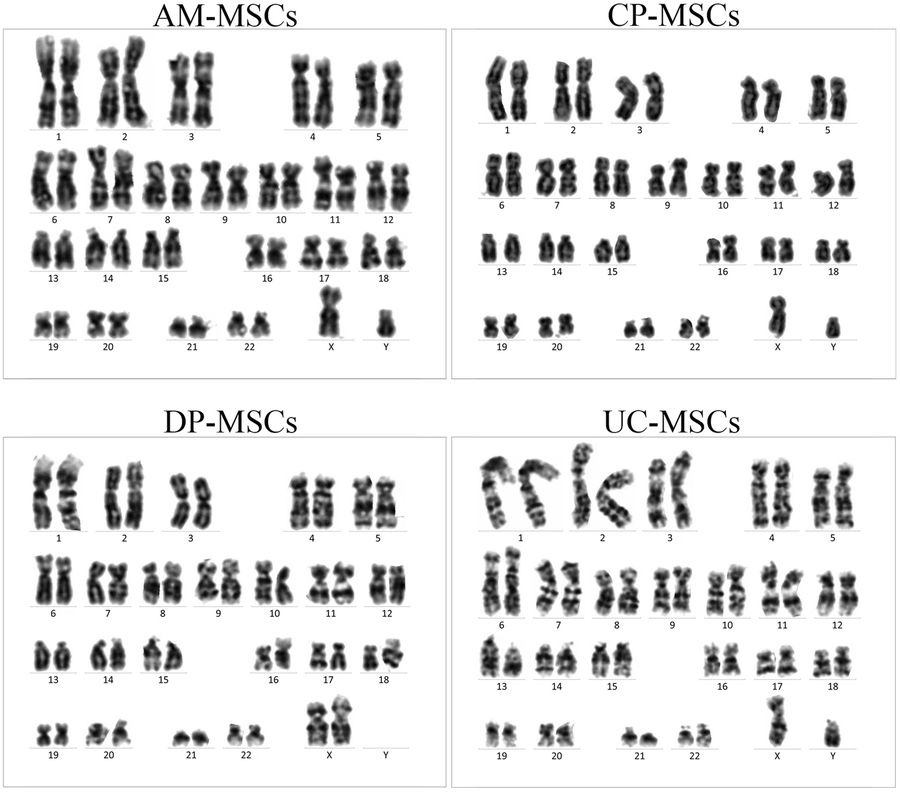 Karyotype analysis of MSCs. (OA Literature)