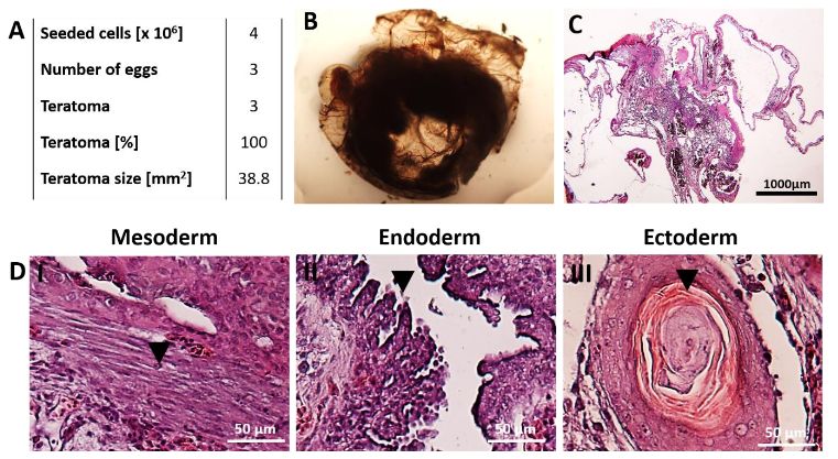 Teratoma formation after seeding hiPSCs. (OA Literature)