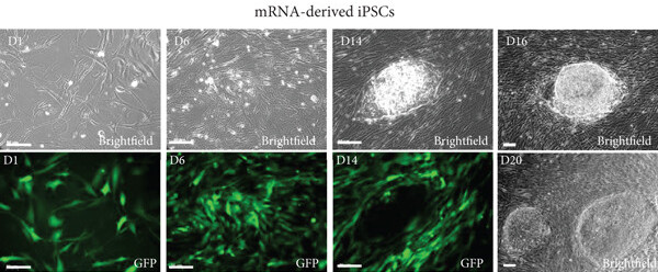 The reprogramming of fibroblasts with synthetic mRNAs. (OA Literature)