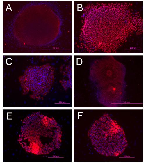 Immunofluorescence staining for pluripotency markers. (Lampuoti, J. 2013)