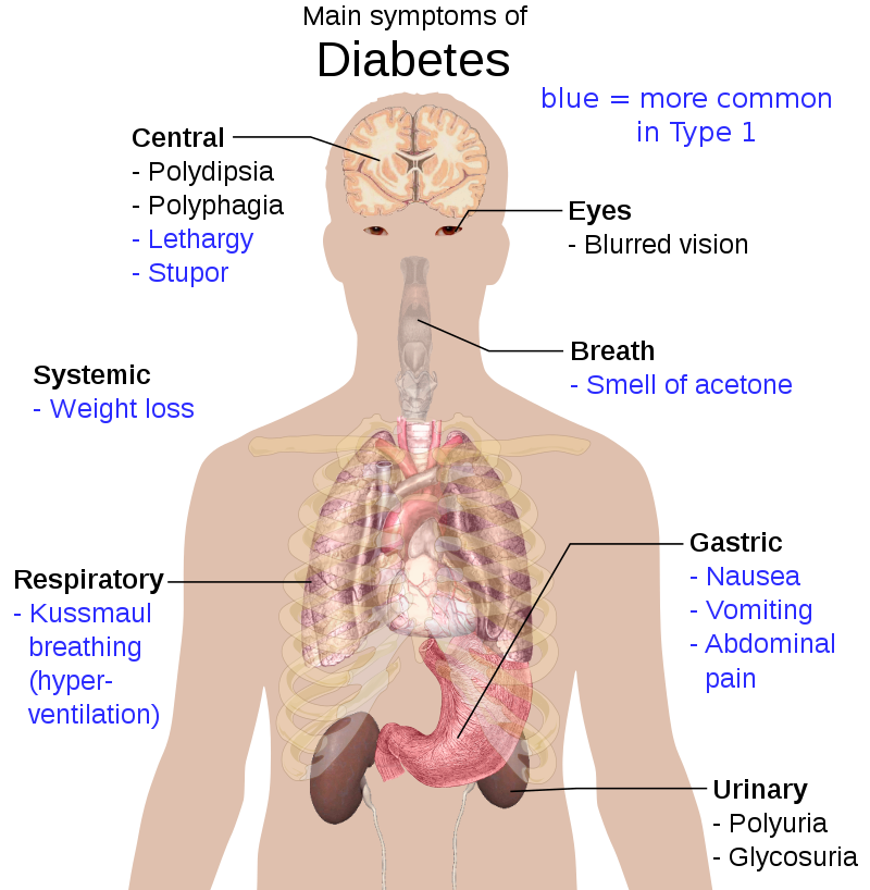 Overview of the most significant symptoms of diabetes.