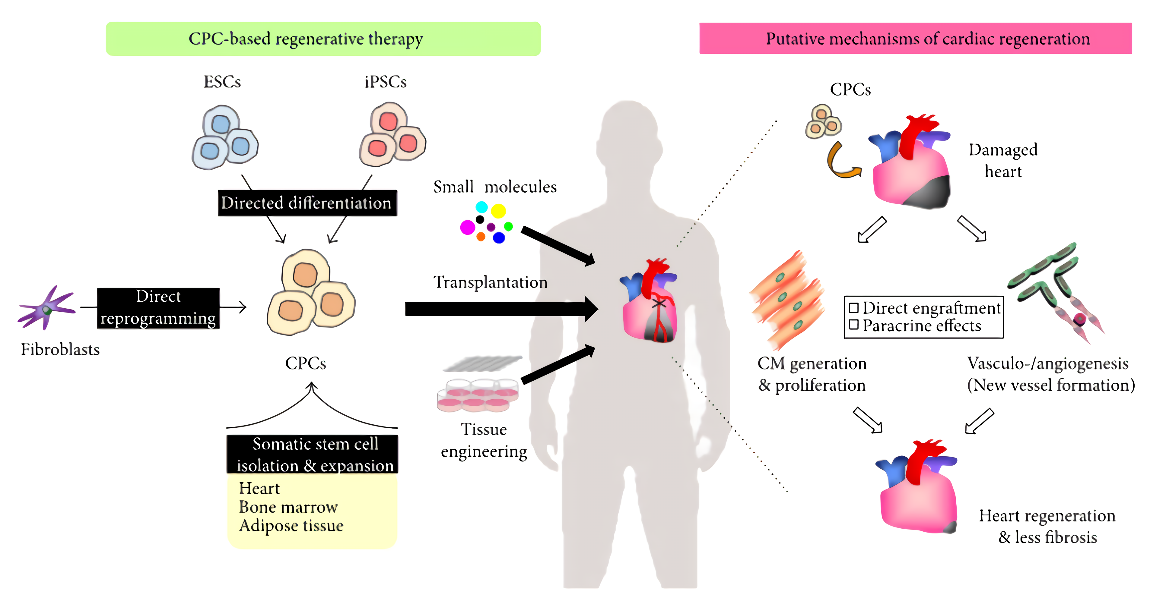 CPC-based regenerative therapy for heart disease.