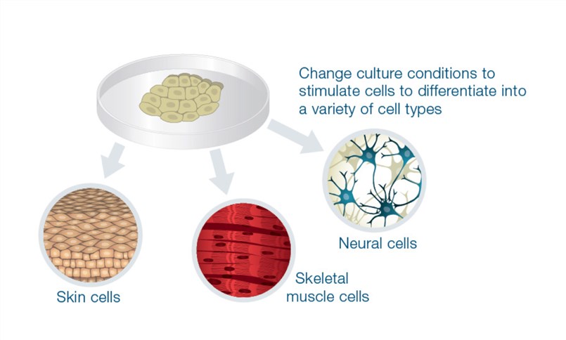 Disease-specific stem cell therapy development
