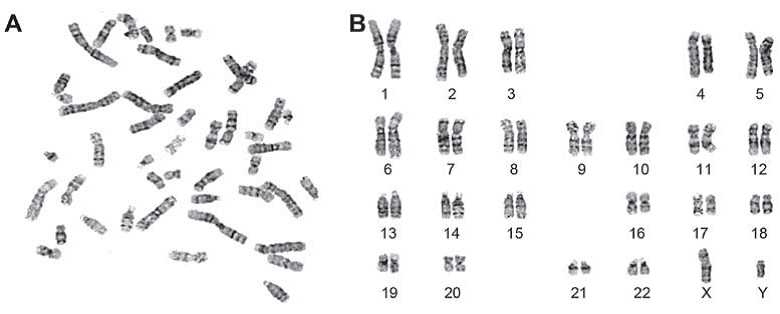 The karyotype of iPSCs.