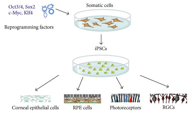 Schematic illustration of iPSC induction and reprogramming into ocular cells.