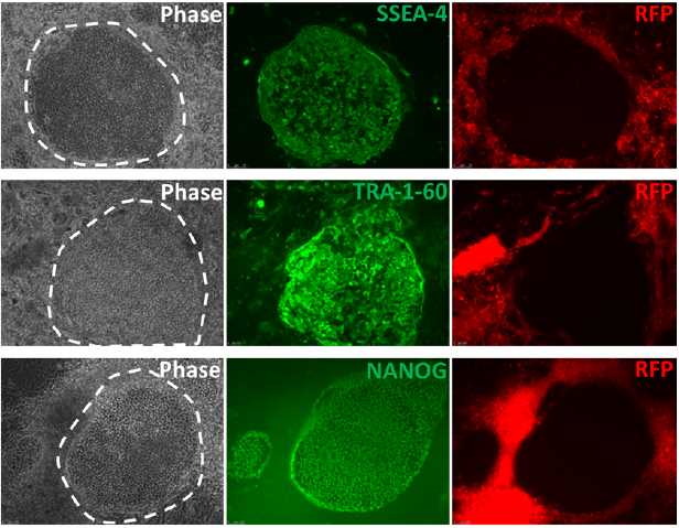 Expression of the pluripotency markers (SSEA-4, TRA-1-60, and NANOG) in the colonies during reprogramming.