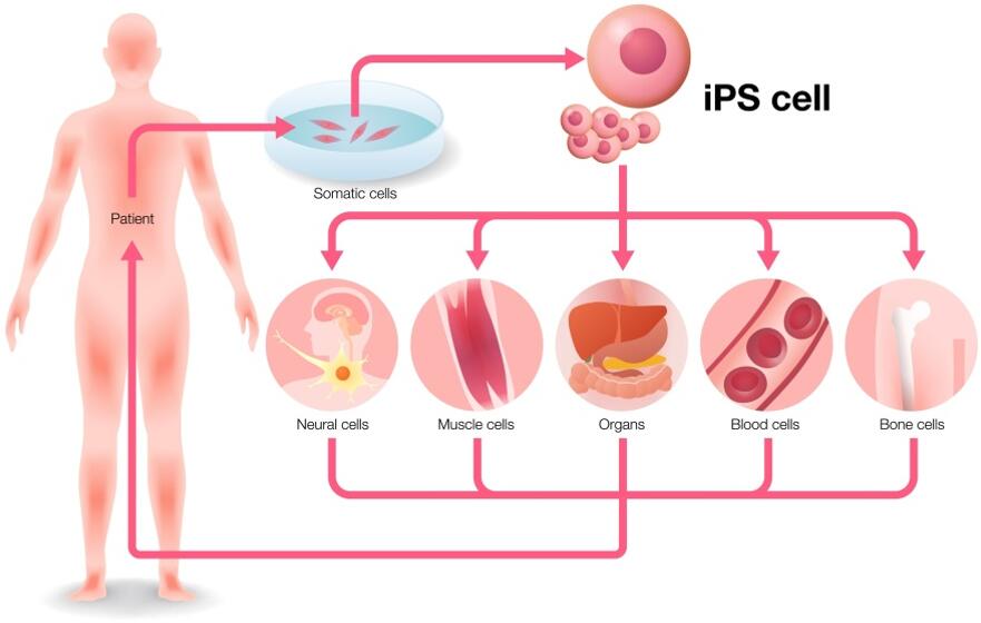 Application of patient-derived iPSCs for disease modeling.