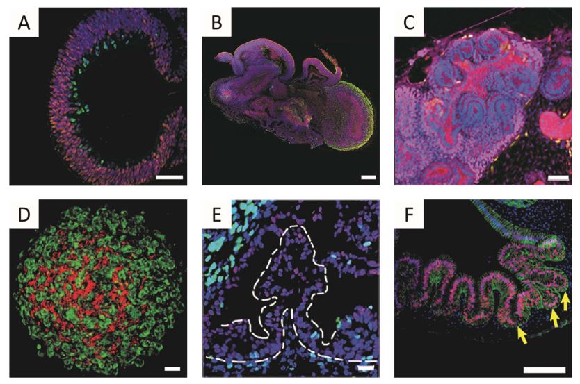 Generation of different organoids using iPSCs in 3D environments. (Li, Y., 2017)