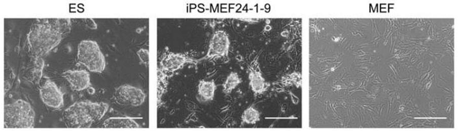 The morphology of ESCs, iPSCs, and mouse embryonic fibroblasts (MEFs).