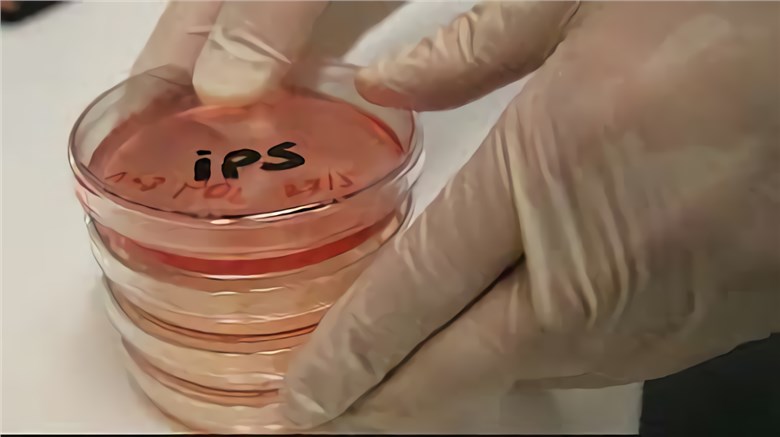 Induced pluripotent stem (IPS) cells.