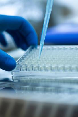 iPSC Culture (Creative Biolabs Authorized)