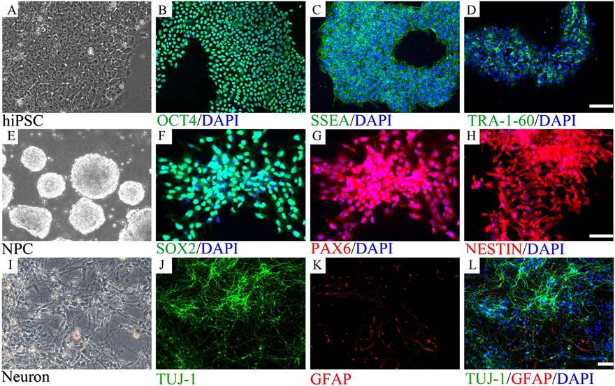 In vitro neuronal progenitor cell model. (OA Literature)