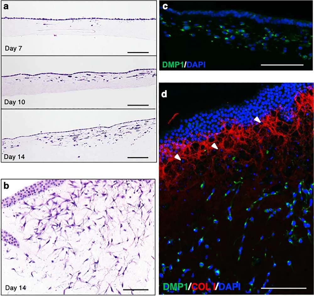 Induction of osteoblastic and osteocytic cells on type I collagen gel. (OA Literature)