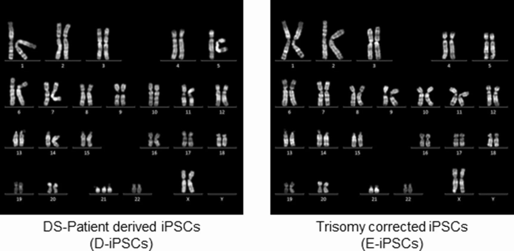 Karyotype analysis of the iPSC. (OA Literature)