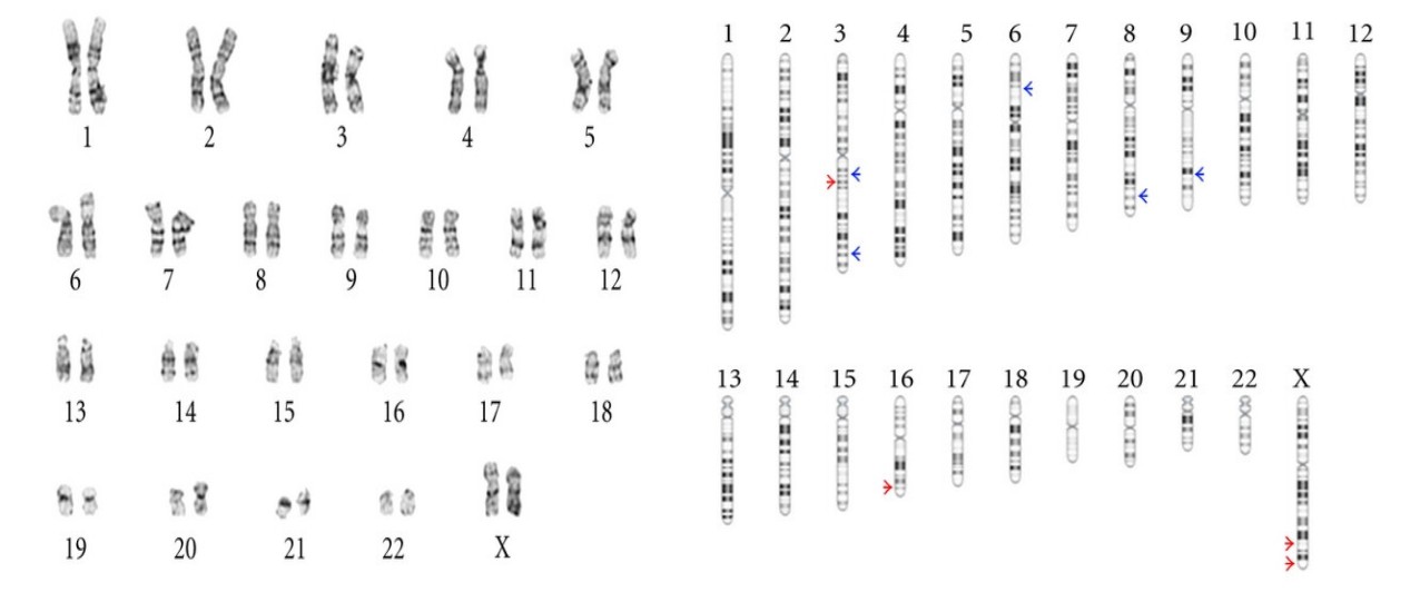 Genomic stability profiling of iPSC line by karyotype analysis.(OA Literature)