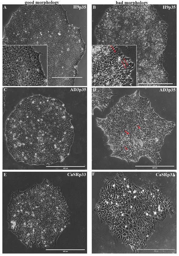 Morphological features of hPSC colonies. (OA Literature)