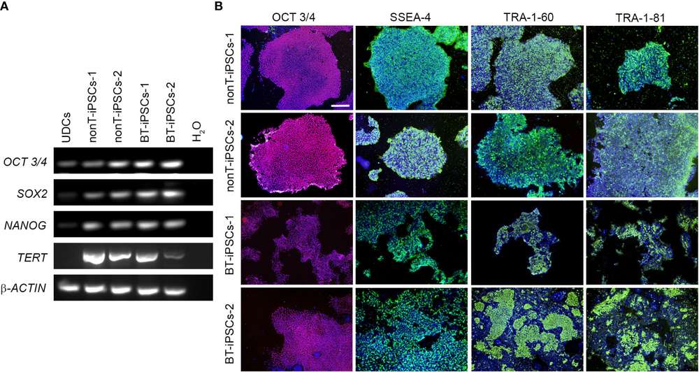 The gene expression of pluripotency markers of the generated cell lines. (OA Literature)
