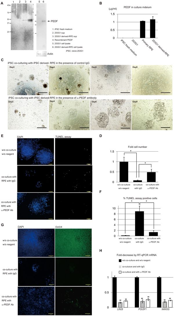 Figure showing PEDF protein detection, ELISA quantification, and PEDF neutralization experiments in iPSC-derived RPE conditioned medium
