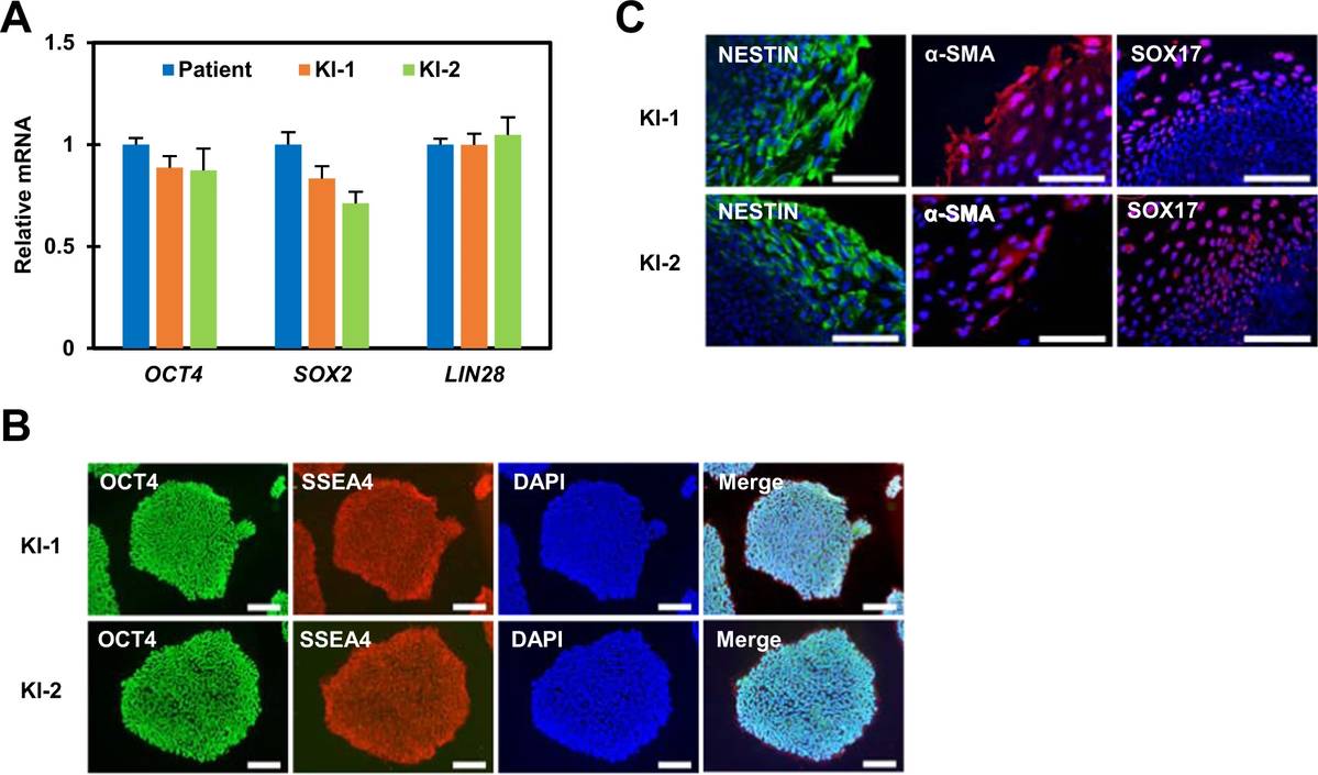 The pluripotency analysis of gene-corrected iPSC lines. (OA Literature)