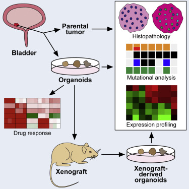 Tumor evolution and drug response in patient-derived organoid models of bladder cancer.