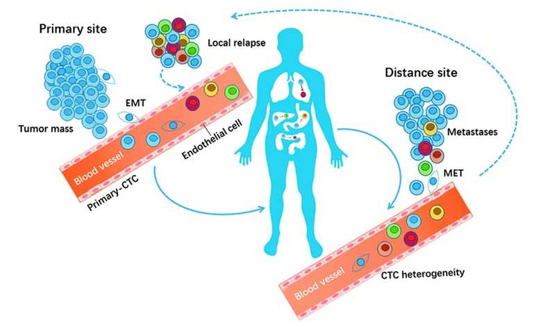 Schematic representation of the participation of CTCs in multiple stages of metastasis.