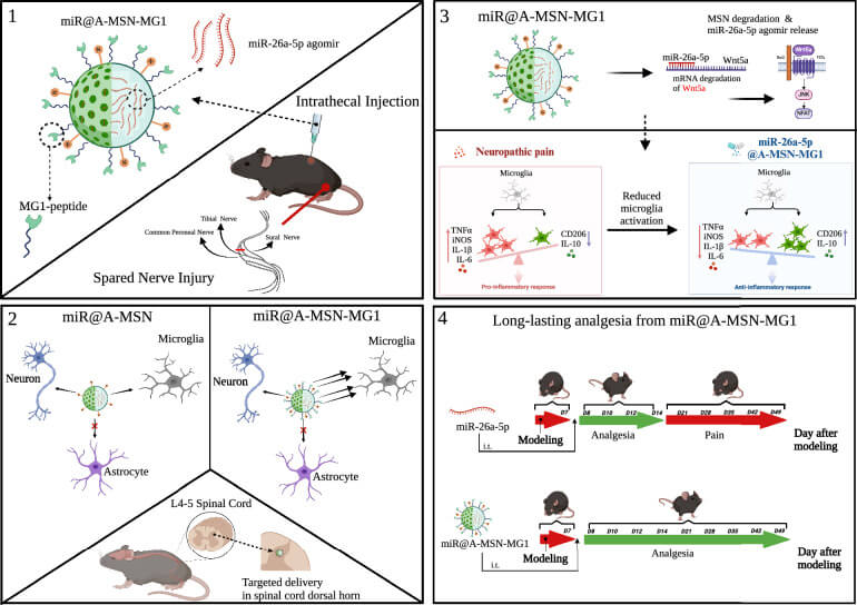 Schematic of microglia-targeting strategy based on nanoparticle-mediated delivery. (OA Literature)