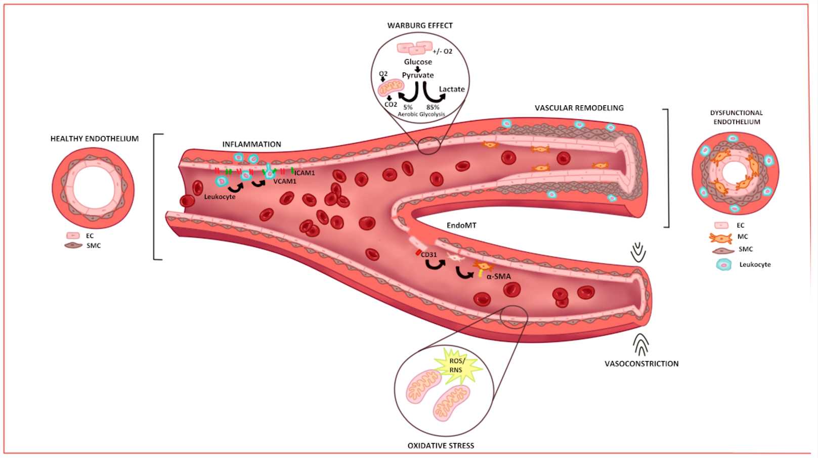 Schematic of main mechanisms of pathology in endothelium. (OA Literature)