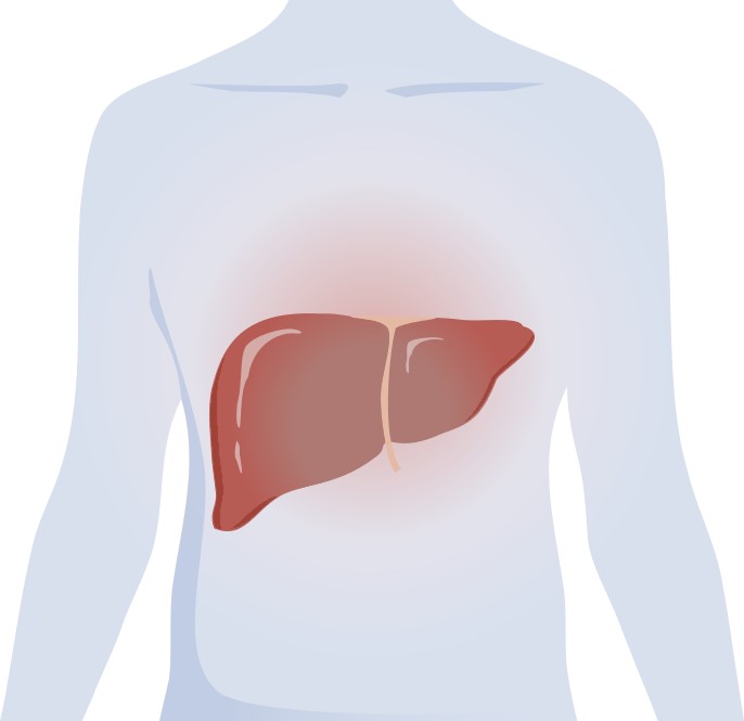 Fig.1 An image of glioma. (Creative Biolabs Original)