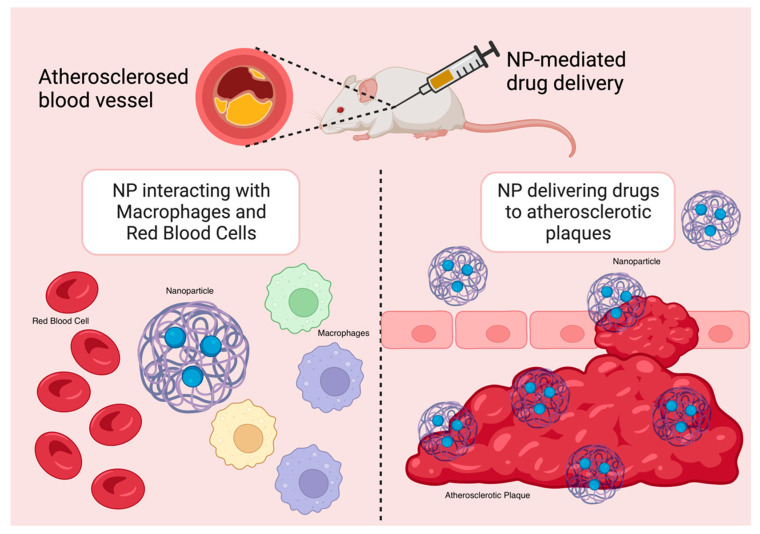 Fig.1 An image showing nanoparticle targeting atherosclerotic plaques in mouse models. (OA Literature)