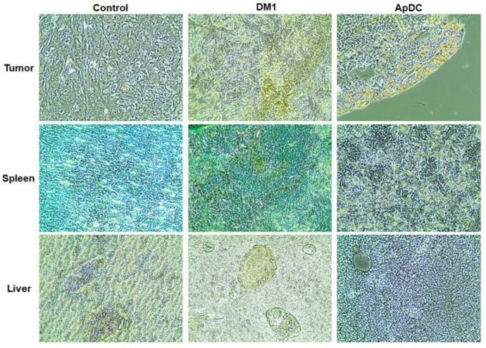 Schematic of histochemical changes by the administration of HER2 aptamer-DM1 conjugate. (OA Literature)