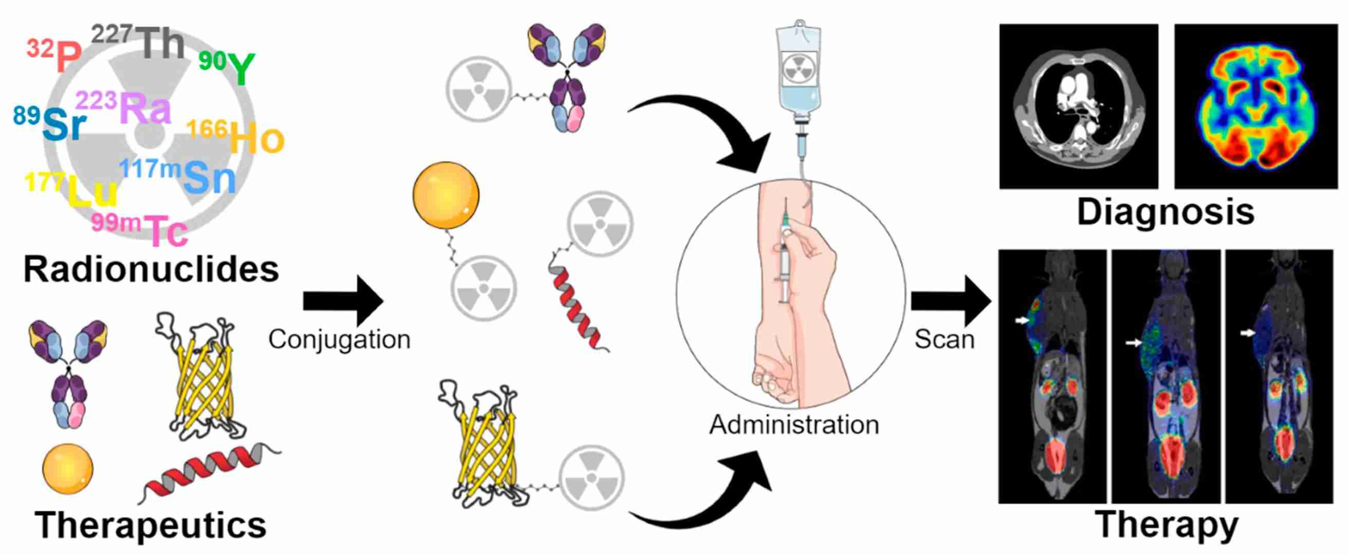Schematic figure illustrating the use of radionuclides as theragnostics. (OA Literature)